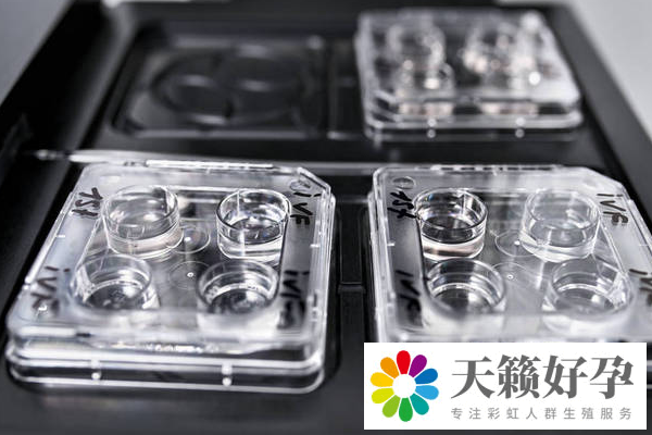 試管嬰兒和自然懷孕的區(qū)別是什么