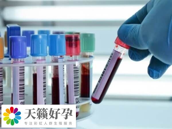 試管移植后要抽血查是否懷孕了