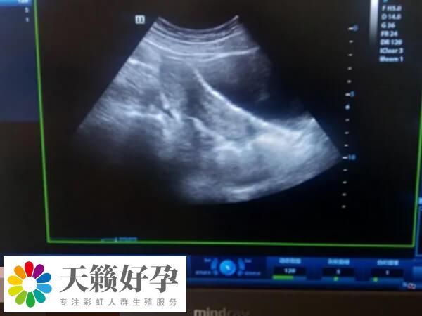 內(nèi)膜形態(tài)異常一般不建議移植鮮胚